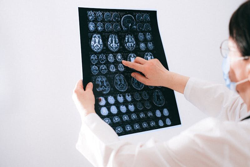 When Do You Need an MRI After a Car Accident?